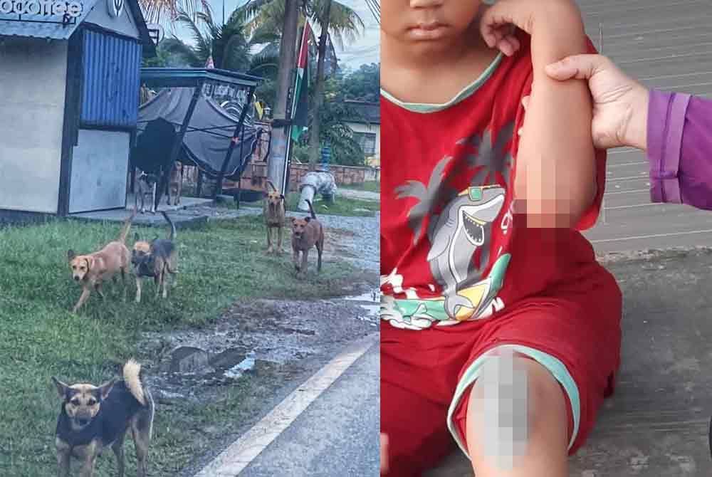 Sekumpulan anjing liar dirakam oleh penduduk yang dikongsi di Facebook. Siti Rahmah (kanan) menunjukkan siku anaknya yang cedera dalam kejadian Januari lalu.