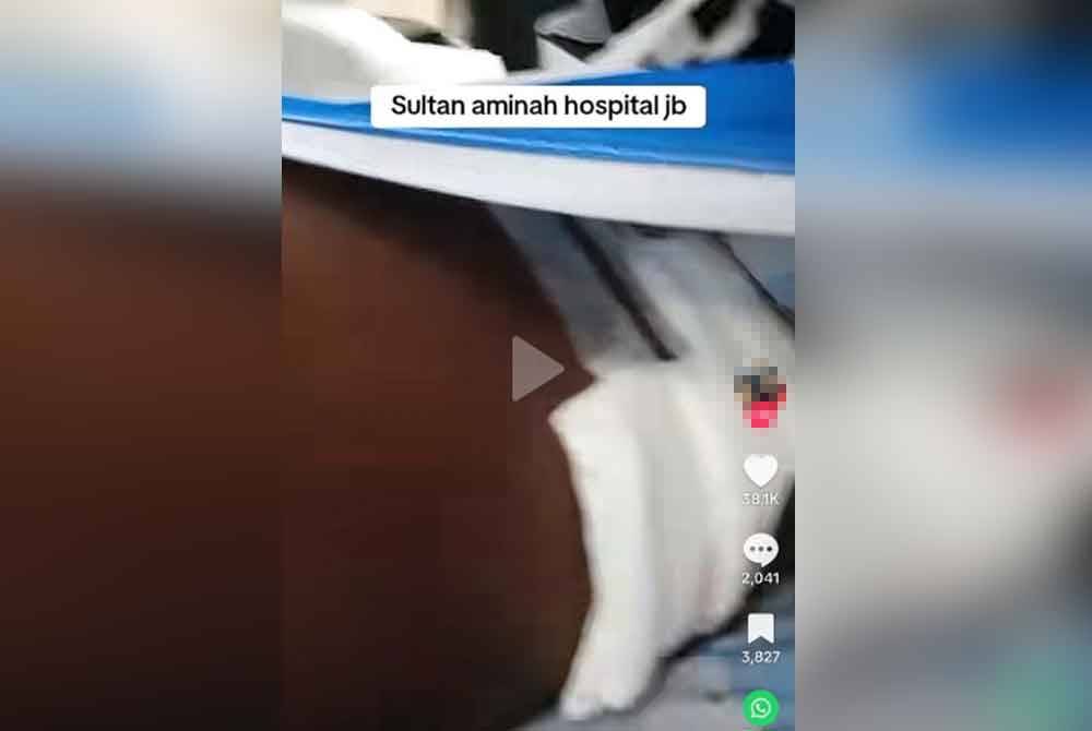 Tangkap layar menunjukkan paha kanan seorang lelaki cedera digigit anjing yang dirawat di HSA, Johor Bahru. Foto media sosial