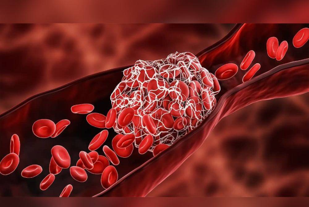 TTS melibatkan pembentukan darah beku yang boleh menyebabkan sumbatan (trombosis) pada salur darah dan juga penurunan platelet (trombositopenia).