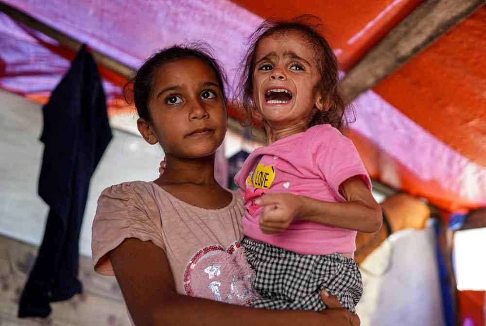 Hana Abdelrahaman al-Rai, 4, didukung oleh kakaknya dan merupakan salah seorang kanak-kanak Gaza yang mengalami malnutrisi.