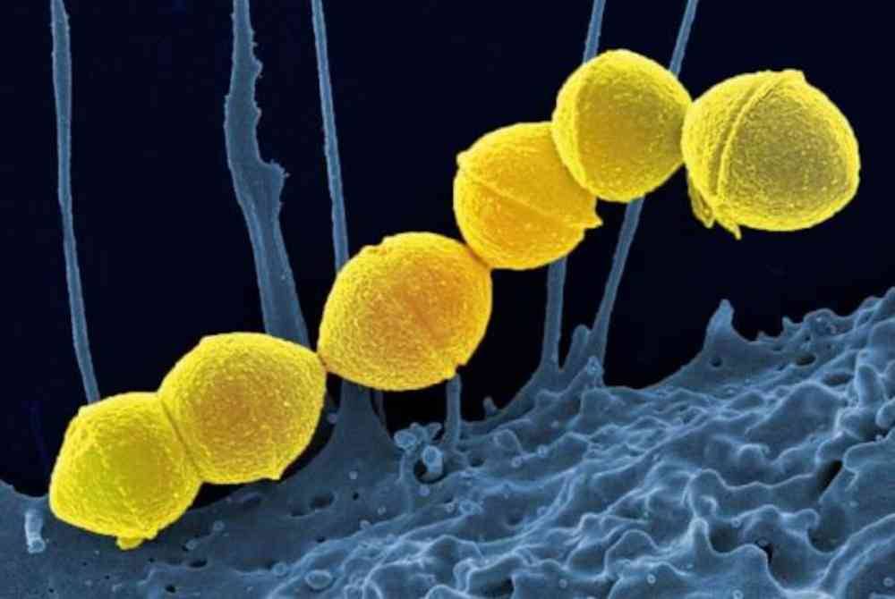 Bakteria Streptococcus A. STSS disebarkan terutamanya melalui titisan daripada mukosa hidung atau tekak, dan melalui sentuhan dengan luka. Foto NIAID