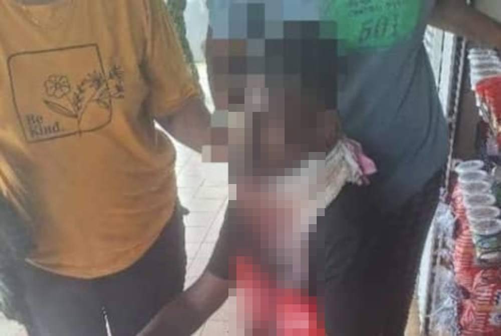 Mangsa yang cedera di leher mendapatkan rawatan di Hospital Enche Besar Hajjah Khalsom, Kluang. Foto tular