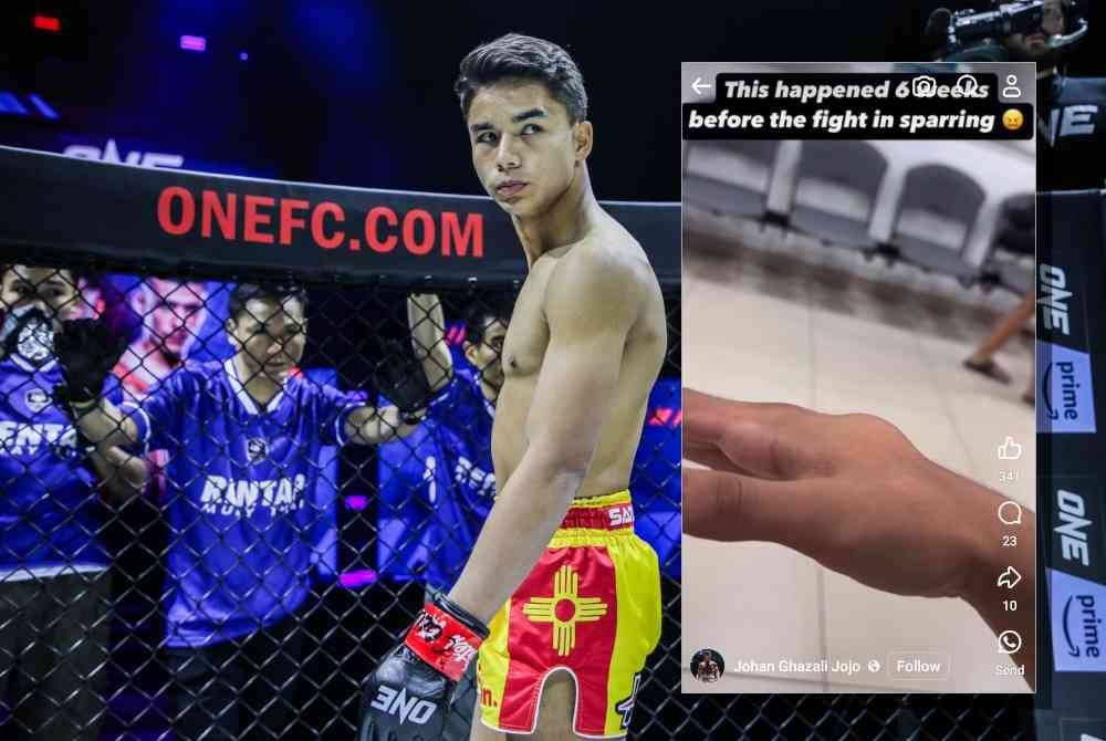 Jojo mendedahkan dia patah tangan sebelum pertarungan dengan Josue Cruz dalam aksi ONE 168: Denver pada Sabtu.