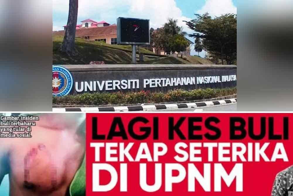 Lagi kes buli tekap seterika dilaporkan di UPNM. 