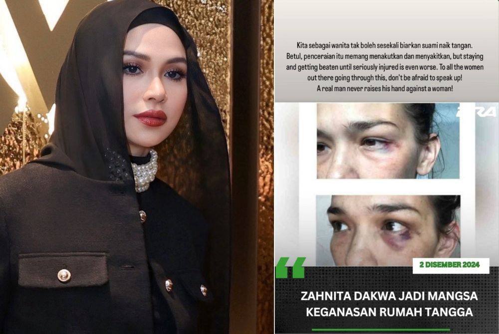 Status di Insta Story Anzalna yang menyeru golongan wanita supaya tidak berdiam diri sekiranya menjadi mangsa keganasan rumah tangga.