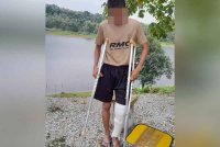 Gambar terkini keadaan kaki mangsa buli yang masih berbalut selepas diarah melakukan &#039;hell&#039; melampau.