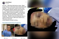 Mangsa didakwa dipukul sehingga parah dan turut mengalami kecederaan di muka dan kepala malah lidah mangsa perlu dijahit.