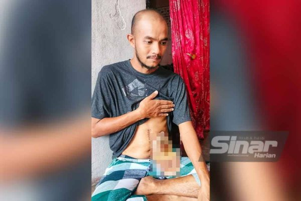 Mohamad Mustaza disahkan menghidap kanser usus tahap dua sejak November lalu. Foto Sinar Harian